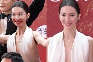 金晨整容后遗症明显：面部僵硬美感全无